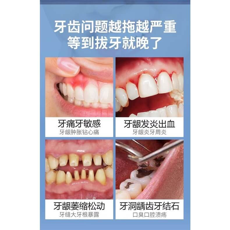 李時珍牙科分離劑